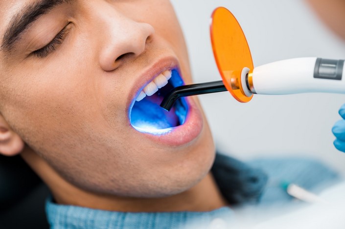Revolutionizing Gum Disease Treatment: Laser Periodontal Therapy Explained