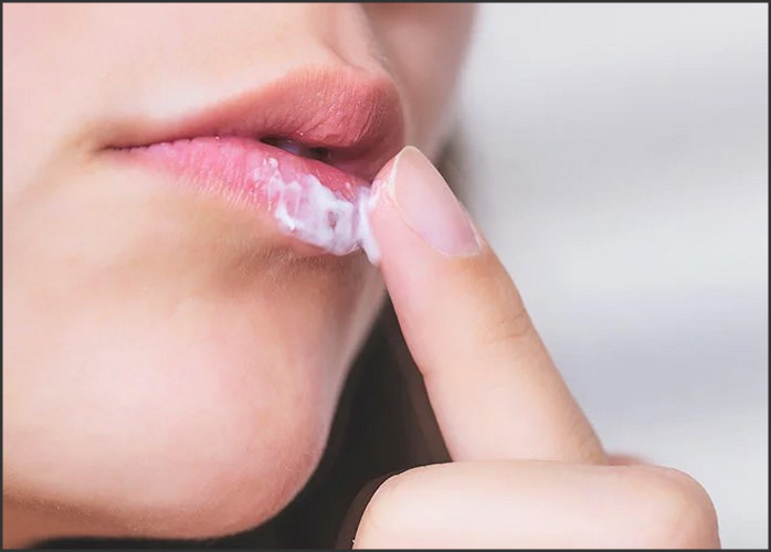 Home Remedies for Lip Sores: Tips for Managing Painful Lip Lesions