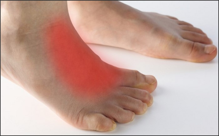 Pulled Tendon on Top of Foot: Causes, Symptoms, and Treatment Options