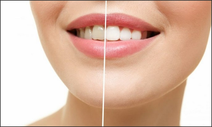 How to Whiten Your Teeth: Tips and Methods for a Brighter Smile
