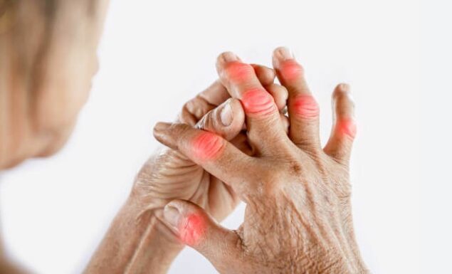 Managing Swollen Hands and Fingers: Causes and Solutions - Healthtruly.com