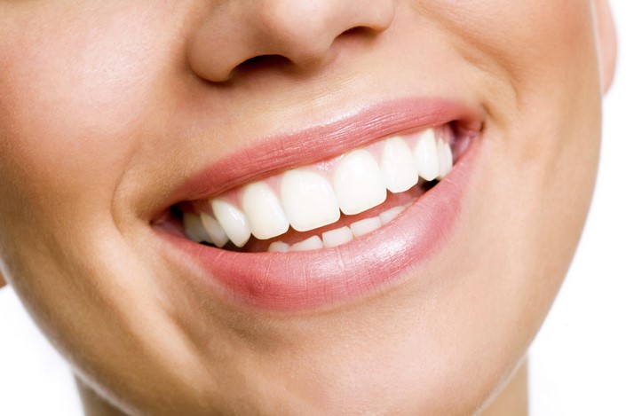 How Much Does It Cost to Get Your Teeth Whitened: Price and Considerations