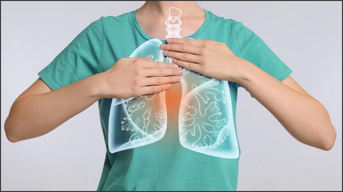 Stages of COPD: Understanding Chronic Obstructive Pulmonary Disease